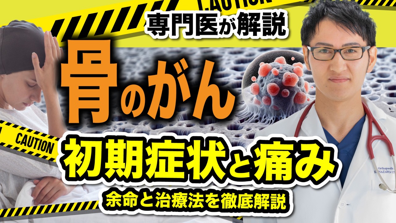骨のがん の 初期症状 と余命 | 骨癌, 骨腫瘍, 骨肉腫 の転移, 痛み,治療法,そして治る可能性を徹底解説