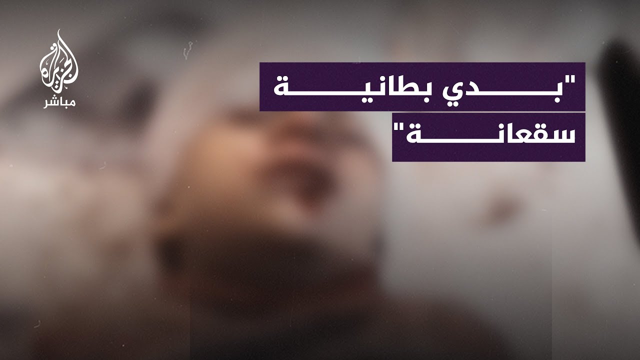 طفلة مصابة ترجف بعد نجاتها من قصف إسرائيلي