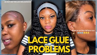 What Lace Glue Is Doing to Women’s Hairlines