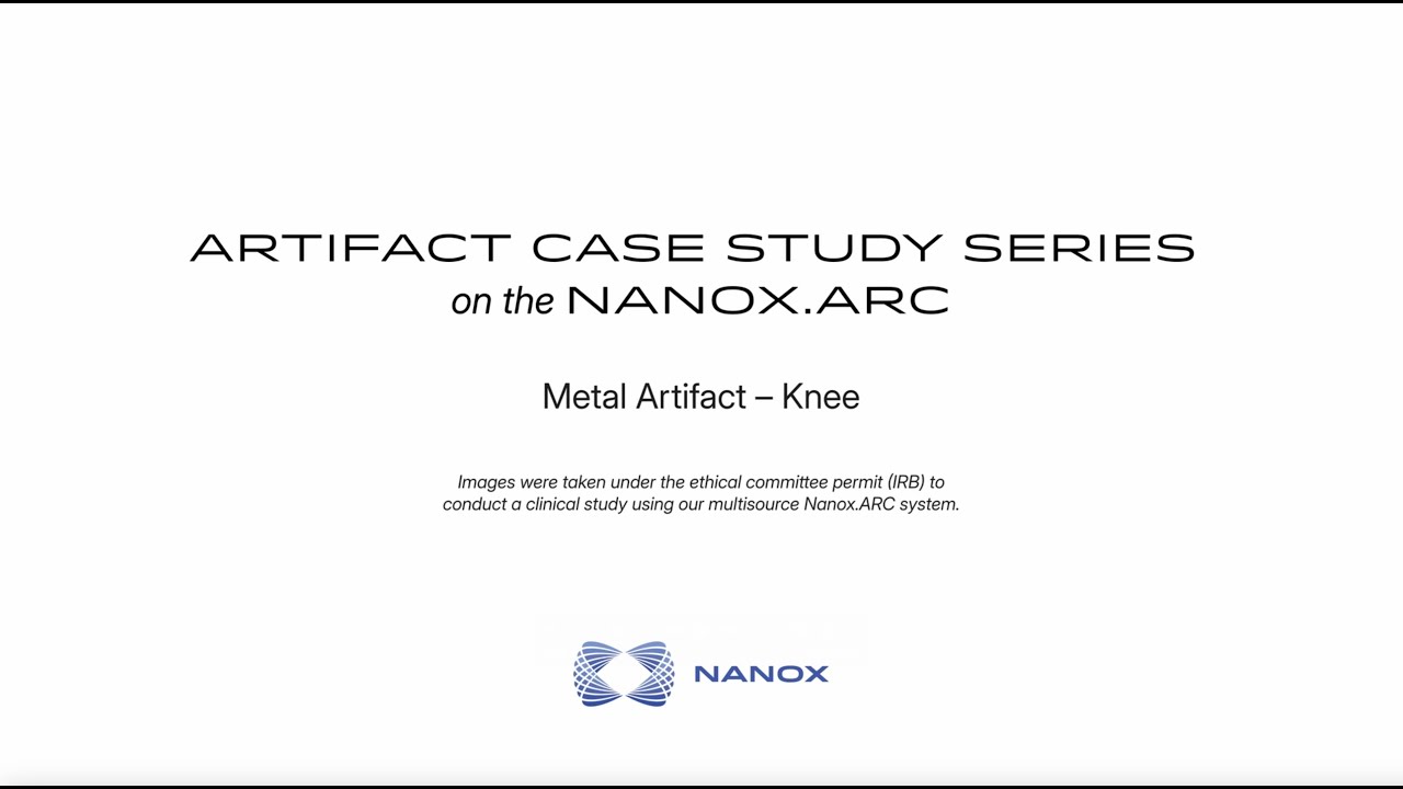 Clinical Case Study | Knee Imaging with Orthopedic Hardware | Nanox Vision