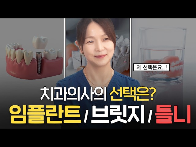 임플란트 vs 브릿지 vs 틀니… 의사라면 부모님께 뭘 해드릴까?