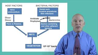 6 Infective Endocarditis Prevention