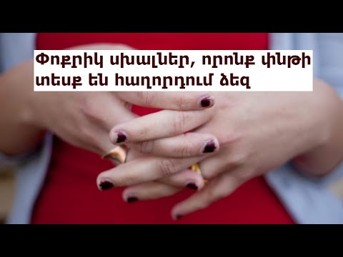 Video: Ինչպես ճիշտ արդուկել իրերը