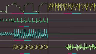 NUiDa - Vi E På DreamHack (Dawud Madmaze Chiptune Remix) (Oscilloscope View) @Dawud-Madmaze-Officiel
