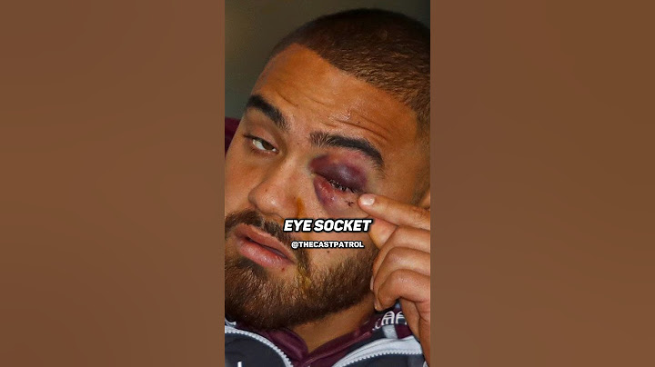 Dylan WALKER vs Curtis SCOTT Fight 🥊