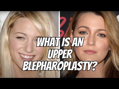 Upper blepharoplasty | Upper eyelid surgery | What is an upper blepharoplasty?