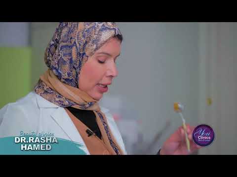 إيه هو الميكرونييدلينج وإيه إستخداماته إعرفوا مع دكتور رشا حامد إستشاري الجلدية والتجميل والليزر