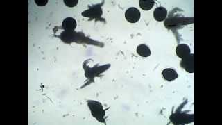 Baby brine shrimp under a microscope