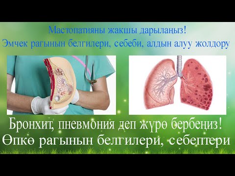 Video: Эмчек рагы тукум куучулукпу?