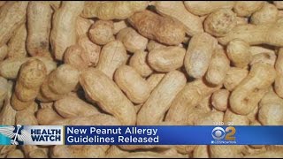 New Peanut Allergy Guidelines