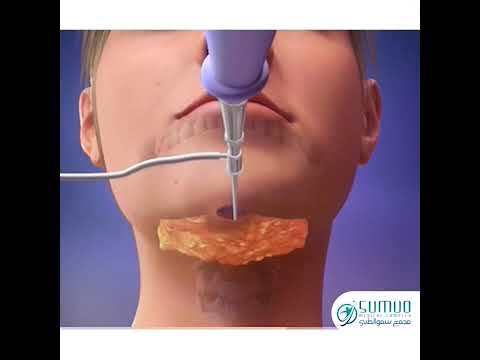 تخلصي من الذقن المزدوج