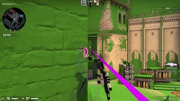 CSGO | HvH #06 | Highlights ft. Unityhacks