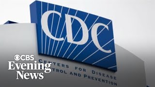 Doctor reacts to Trump health cuts at CDC, FDA and more