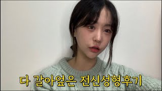 20살에 1년동안 전신을 갈아엎은 성형녀