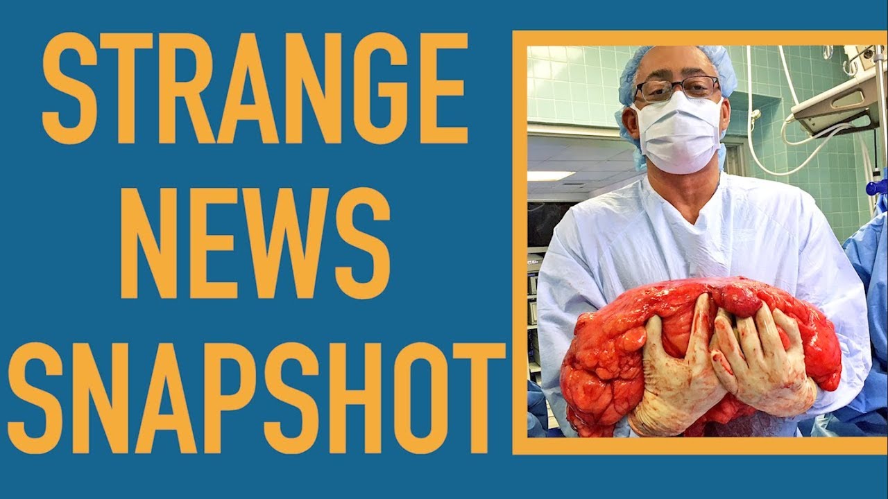 ufos the lost evidence A 30-lb Tumor. 'Nuf Said.