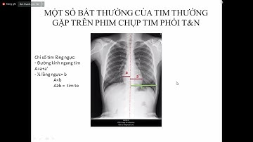 Chẩn đoán hình ảnh modul tim mạch p1
