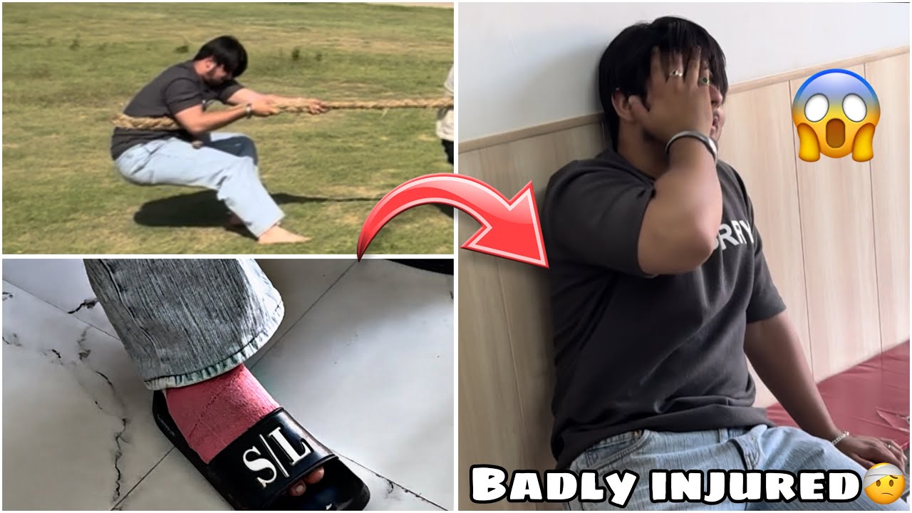 i-got-badly-injured-while-playing-tug-of-war-serious-injury