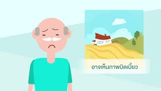 โรคจุดภาพชัดที่จอตาเสื่อมจากอายุ หรือ Age-related Macular Degenneration (AMD)