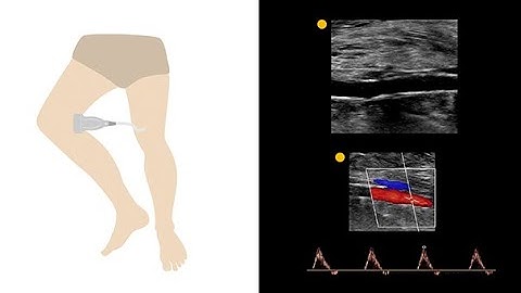 Mastering an arterial duplex protocol