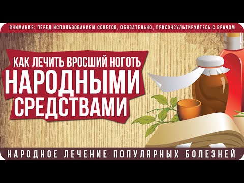 Как лечить вросший ноготь народными средствами в домашних условиях