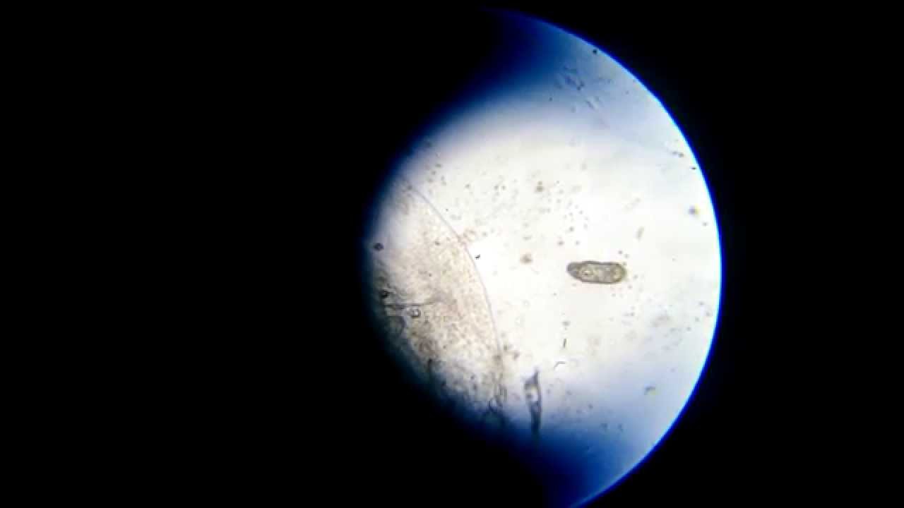 Паразит-сосальщик - гиродактилус (Gyrodactylus)