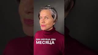2 месяца после подтяжки лица в 60 лет #фейслифтинг
