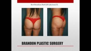 Best Brazilian Butt Lift: Brandon Plastic Surgery- Lakeland, FL
