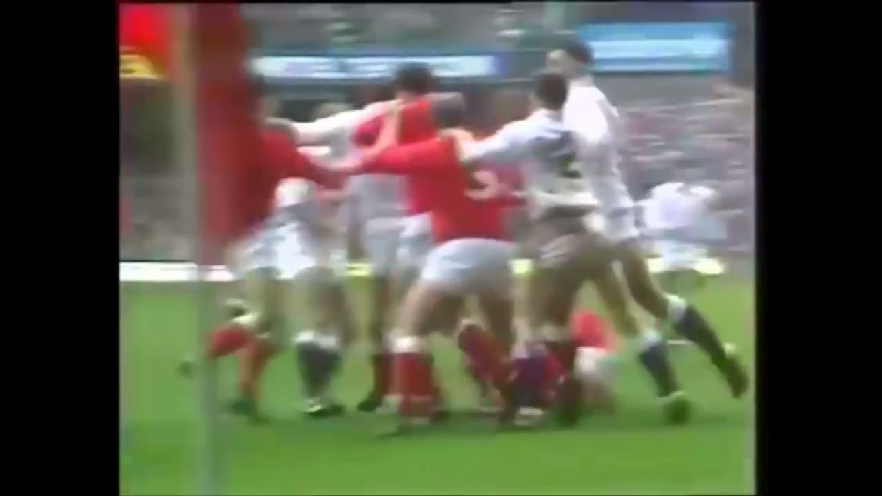 BROKEN JAW - PHIL DAVIES V WADE DOOLEY - WALES V ENGLAND - 1987 RUGBY MATCH