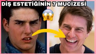 Diş Estetiğiyle Tanınmaz Hâle Gelen 7 Ünlü Cristiano Ronaldo, Beren Saat, Tom Cruise...