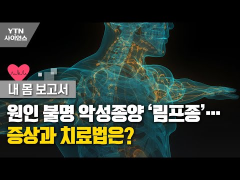 원인 불명 악성종양 ‘림프종’…증상과 치료법은?[내 몸 보고서]  / YTN 사이언스