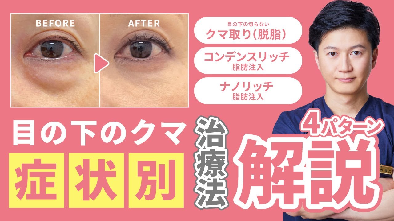 クマ取り】【症状別】施した手術を解説！これさえ見ればあなたもクマ