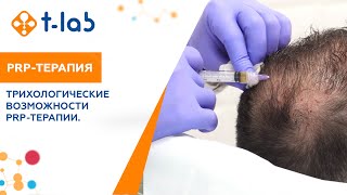 Трихологические возможности PRP-терапии.