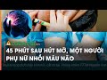 45 phút sau hút mỡ, một người phụ nữ nhồi máu não