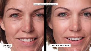 Revitalift Laser x3: Hält was es verspricht | L'Oréal Paris 15''