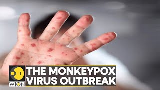 Monkeypox Outbreak: How it spreads, who is at risk? | Latest English News | WION