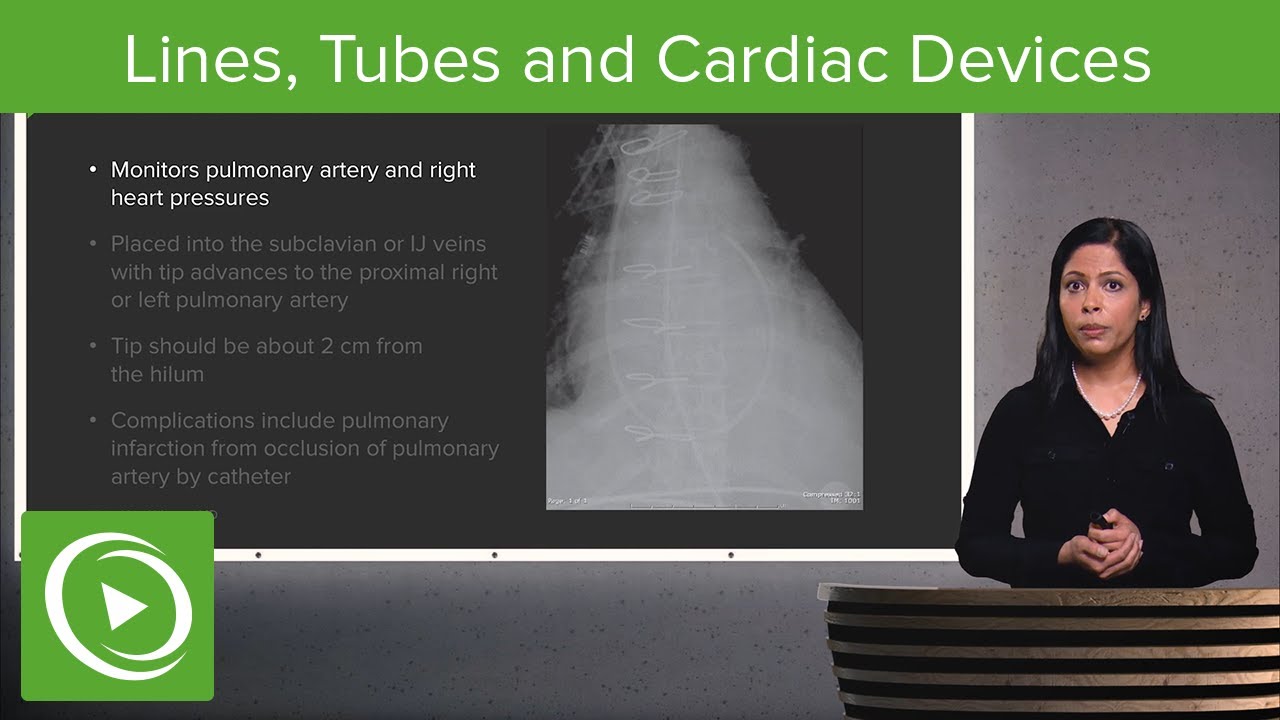Lines, Tubes and Cardiac Devices in Radiology – Radiology | Lecturio