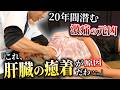 【20年続く激痛】整体もカイロもお手上げ。原因は“肝臓の癒着”…!?