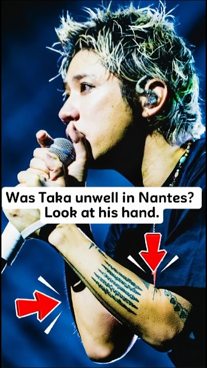 Taka didn’t seem well in Nantes — notice his hand. #oneokrock  #taka #shorts #trending