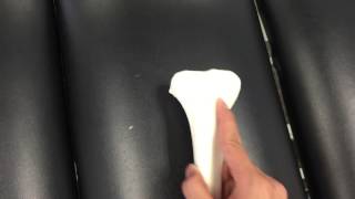 Tibia and Fibula Bony Landmarks