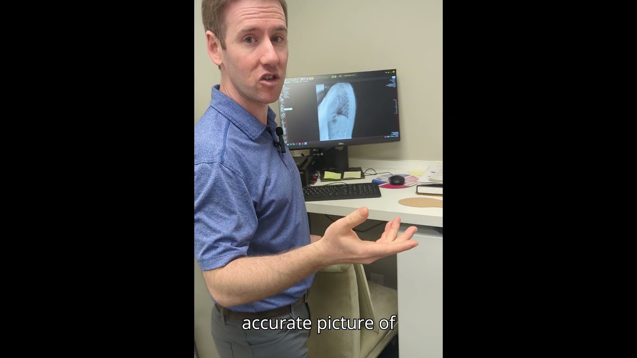 You NEED an x-ray to determine how your spinal alignment affects you and your health! 