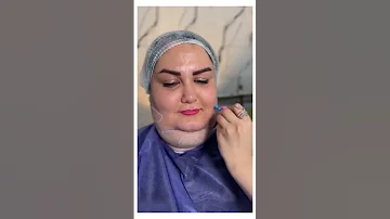 قبل و بعد عمليه اللغلوغ مستحيل تصدق النتيجه 