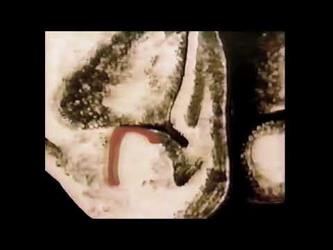 The Big F - Doctor Vine 1989 (Headbangers Ball Full HD Remastered Video Clip)