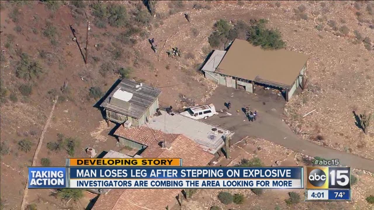 Man loses leg after stepping on explosive