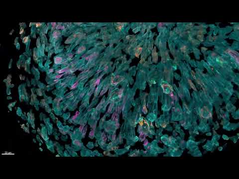 Developing Zebrafish Eye
