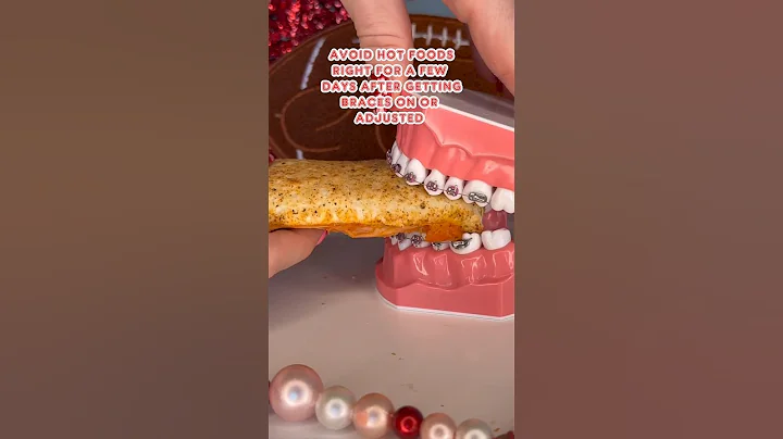 Are you WORRIED about BRACES PAIN? *what to do #braces #orthodontist #pain