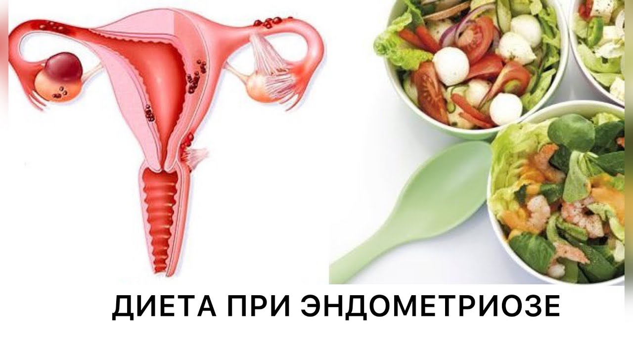 Что кушать после удаления матки. Питание при онкологии шейки матки. Эндометриозе диета. Питание при эндометриозе матки.