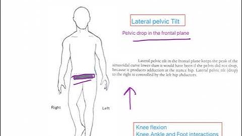 Determinants of Gait part 1   GAIT