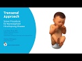 Surgical treatment of Hirschsprung disease-animation
