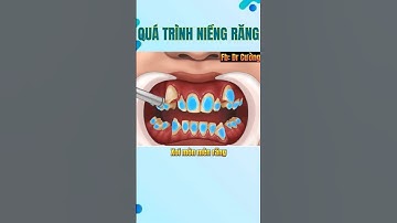 Quá trình niềng răng diễn ra như thế nào ? #drcuong #niengrang #nhakhoa
