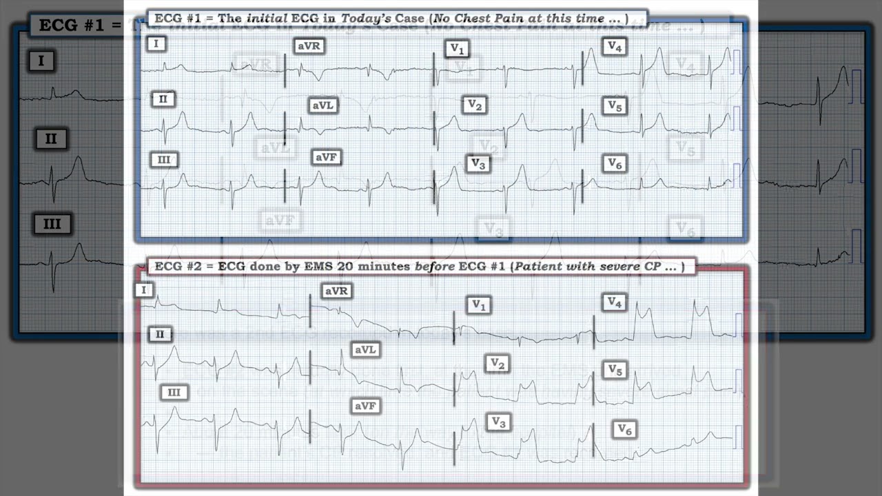 値下げ可能　Advances in Electrocardiology 2004 Cardiac Electrophysiology: From Cell to Bedside: Zipes MD, Douglas